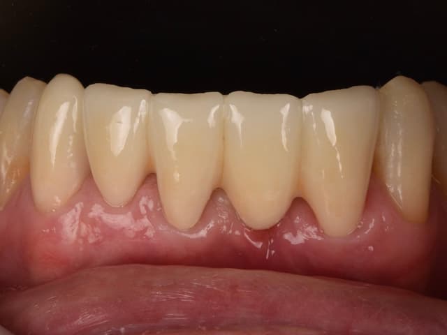 Paciente 6 - Image 5