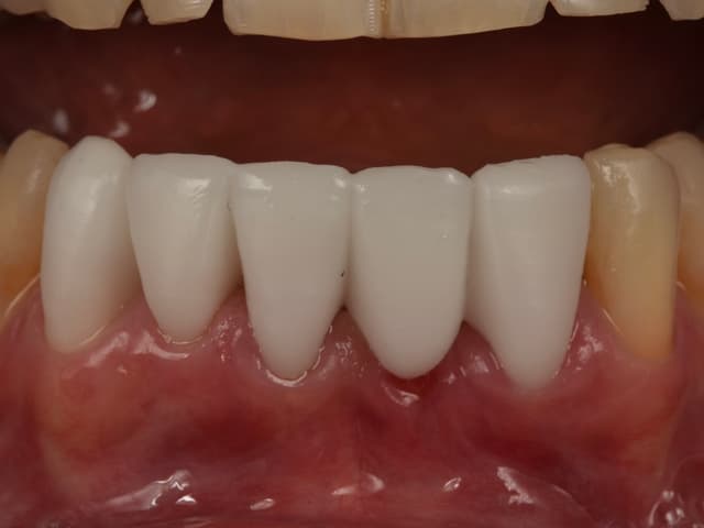 Paciente 6 - Image 3