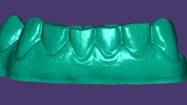 Paciente 4 - Image 2