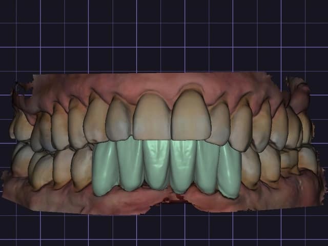 Paciente 1 - Image 3