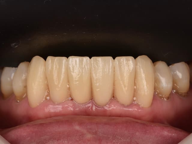 Paciente 1 - Image 5