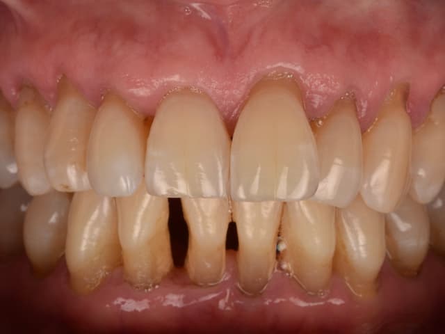 Paciente 1 - Image 1