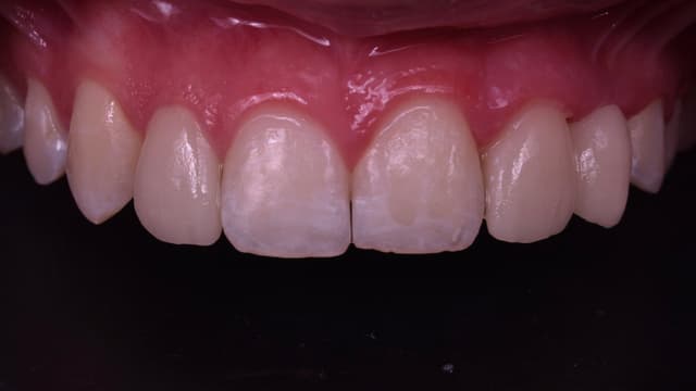 Paciente 3 - Image 4